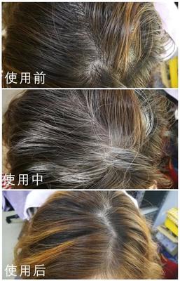 美國甜心傾心推薦，高科技頭發(fā)護理 告別煩惱，擁抱健康秀發(fā)